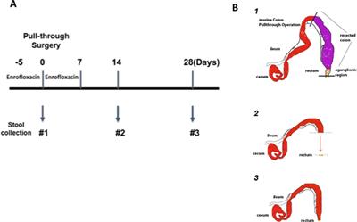 Bacterial Microbiome Dynamics in Post Pull-Through Hirschsprung-Associated Enterocolitis (HAEC): An Experimental Study Employing the Endothelin Receptor B-Null Mouse Model